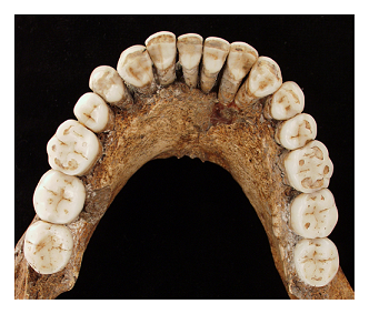 Mandible