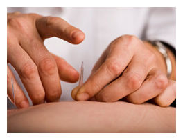 Acupunture