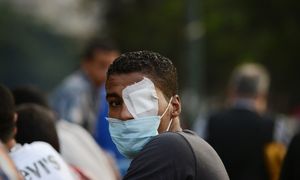 Injured Egyptian protester