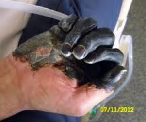 Black Plague