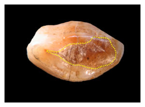Click to enlarge Dental Filing