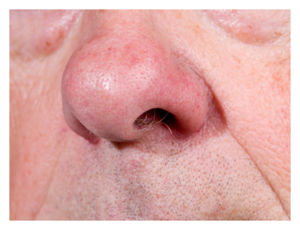 Nose