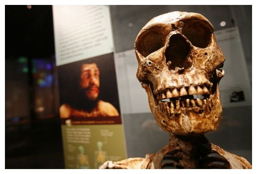 Skull