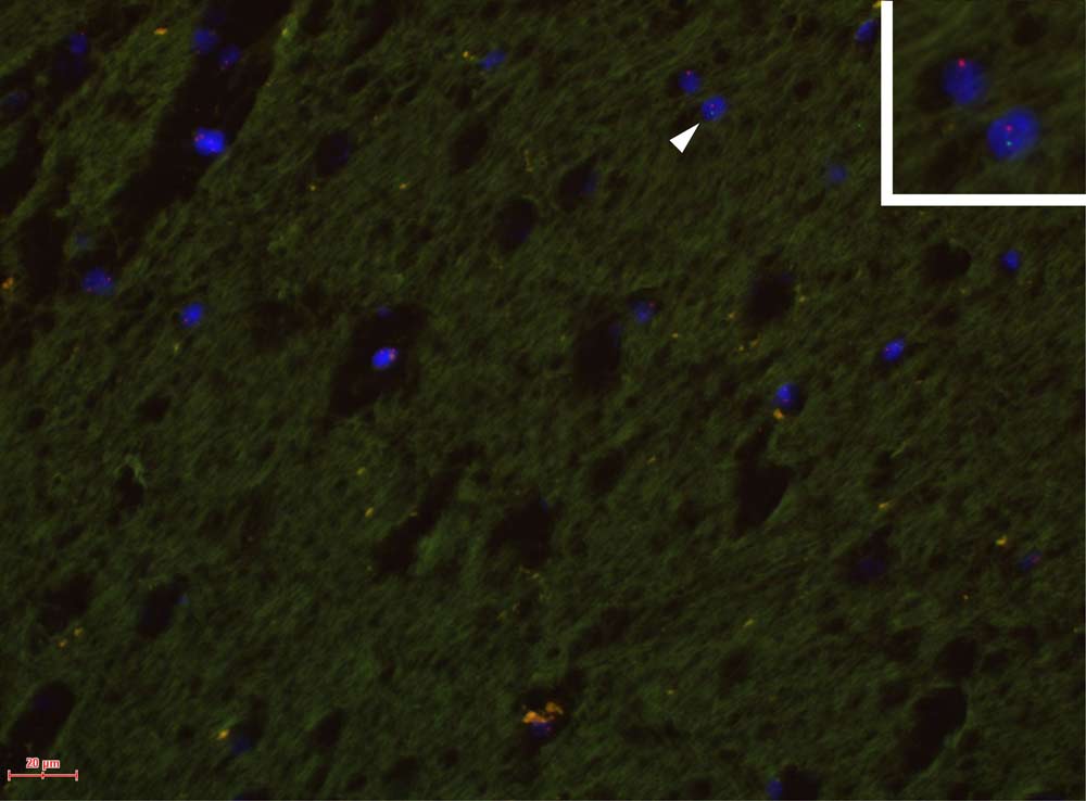 Male Fetal Cells