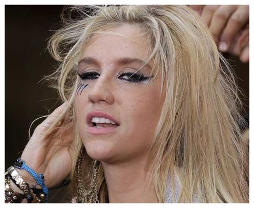 Kesha