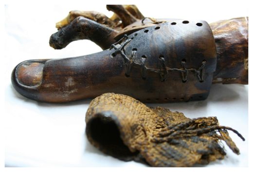 Click to enlarge Prosthetic Toe
