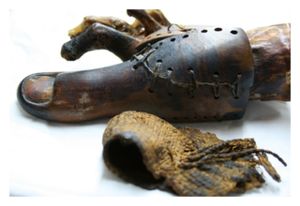 Click to enlarge Prosthetic Toe