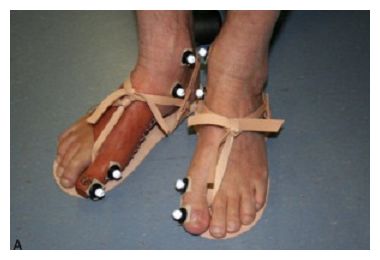 Click to enlarge Prosthetic Toe_1