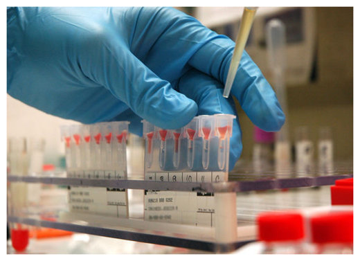 Click to enlarge Blood Test