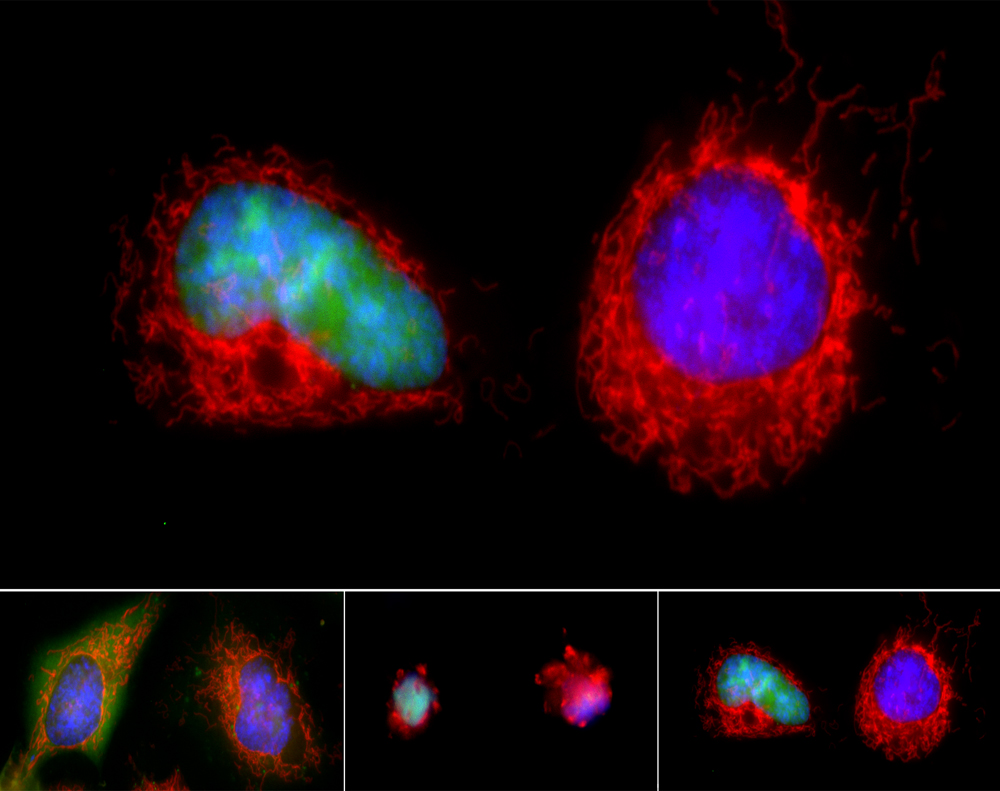 Click to enlarge Cell Apoptosis