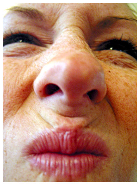 Click to enlarge Smell