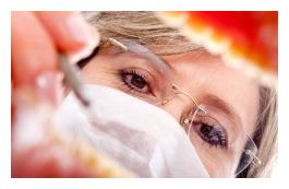 Root Canal