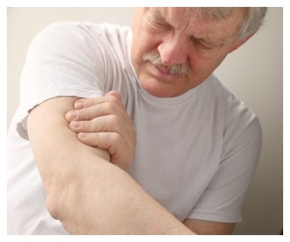 Statins