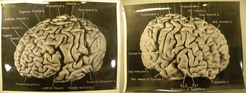 Einstein's brain