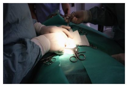 Surgery
