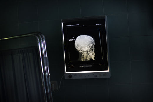  brain X-ray