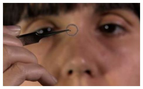 Stem Cell Contact Lens