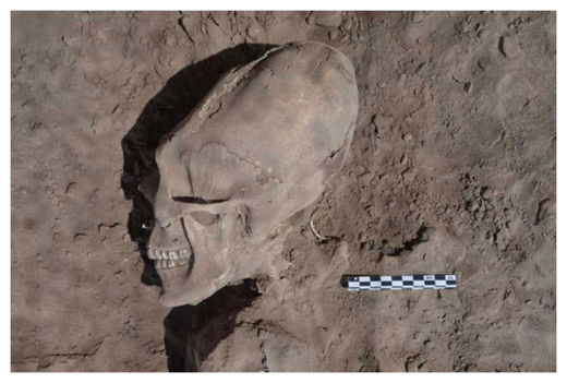 Skeleton_2