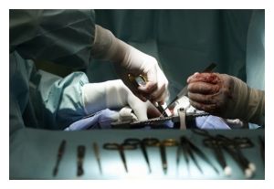 Surgery