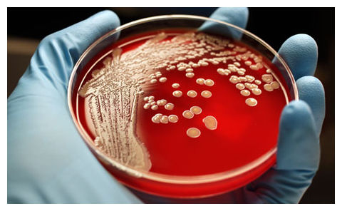 Superbug