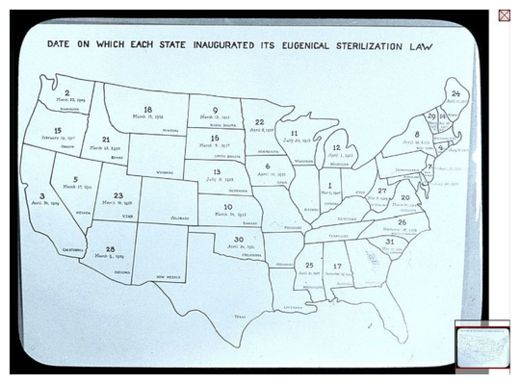 Eugenics