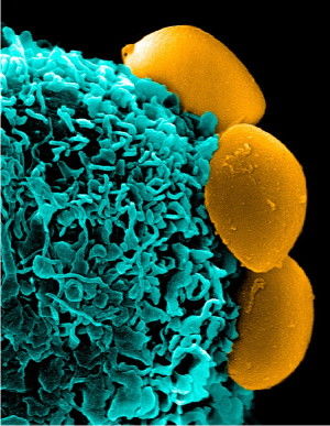 NanoParticles