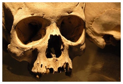 Skull