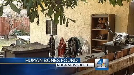 Human Bones