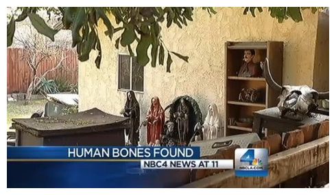 Human Bones