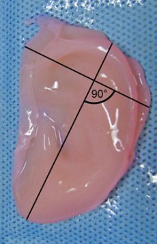 Click to enlarge Bio Ear_1