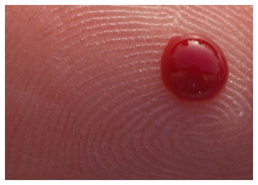 Click to enlarge Blood