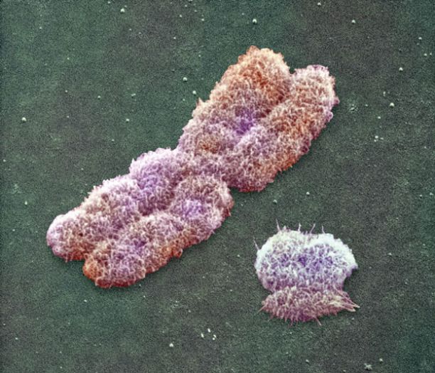 Click to enlarge Y Chromosome