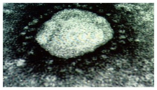 Coronavirus