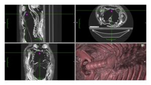Click to enlarge CT Scan of Mummy
