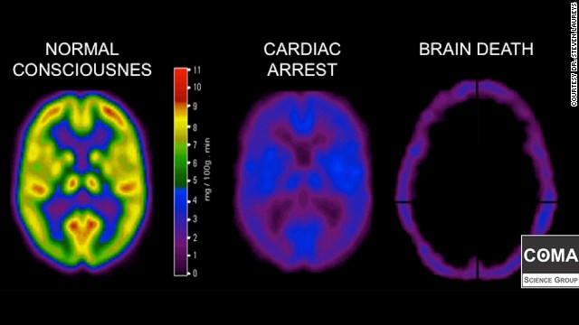 Brain Scans