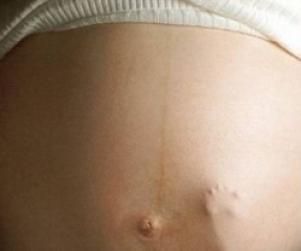 pregnant