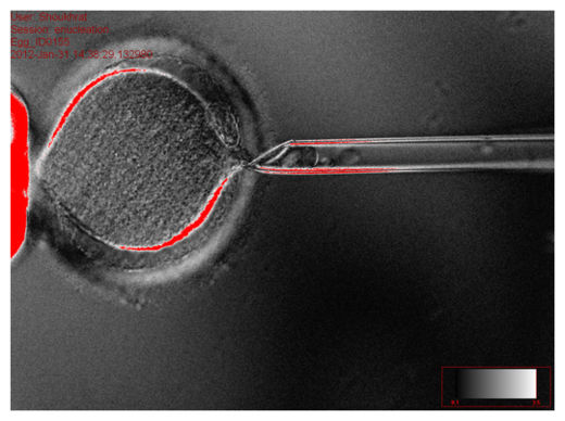 Human Cloning