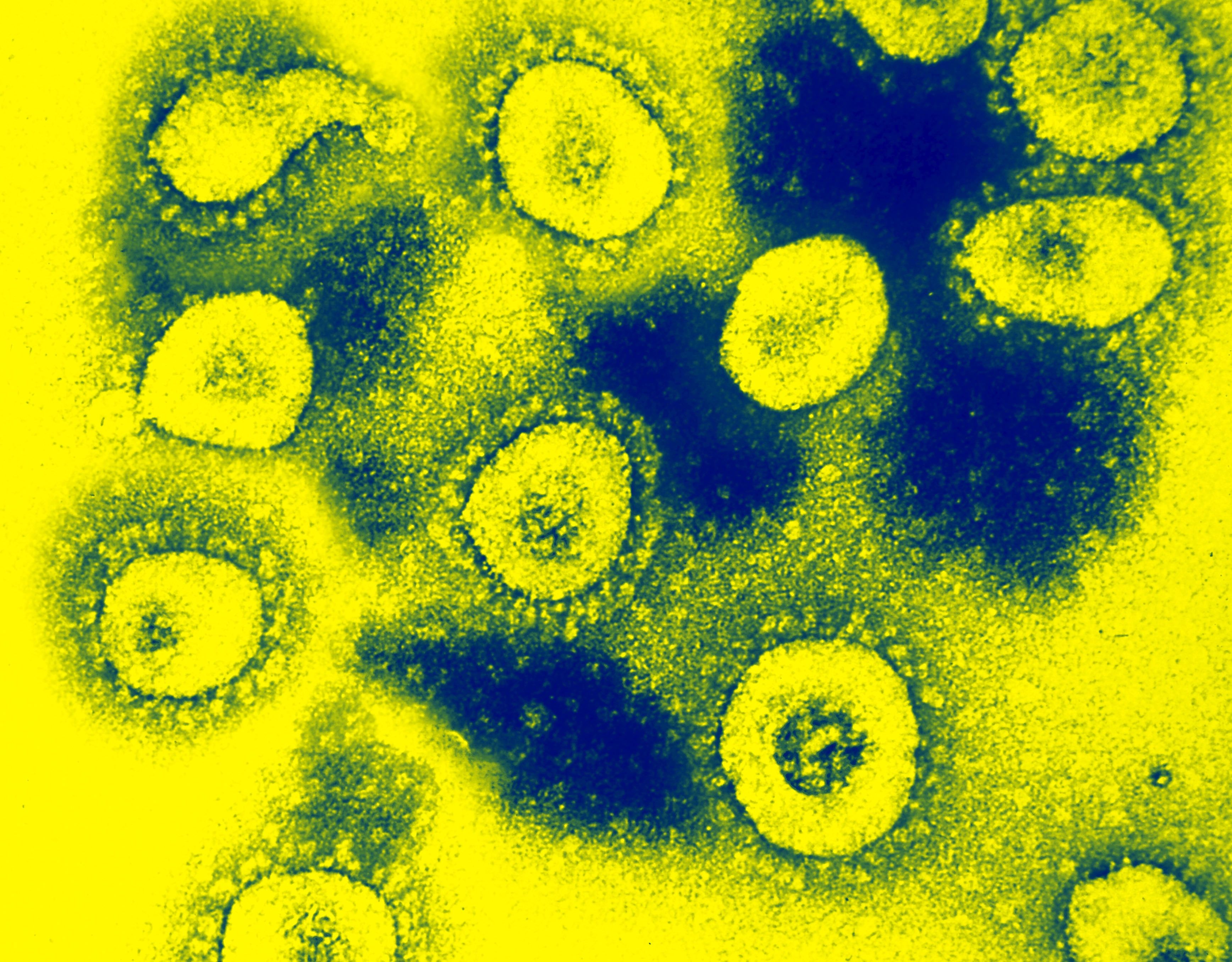 Novel Coronavirus: New SARS-Like Virus -- Health & Wellness -- Sott.net3472 x 2712