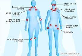 Click to enlarge Fibromyalgia