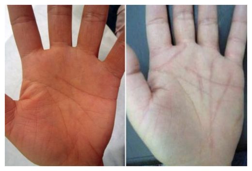 Palmistry