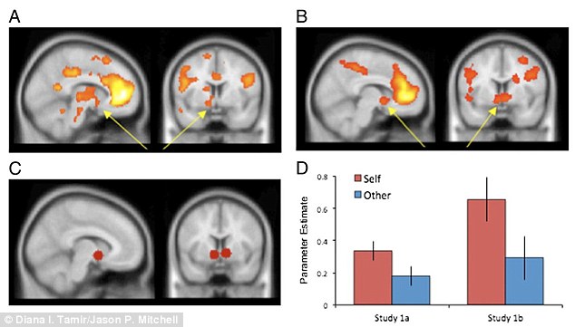 fMRI pics