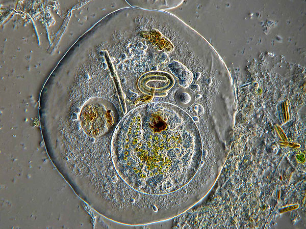 Naegleria fowleri