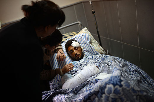 Injured Syrian Kurd