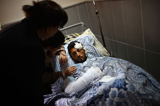 Click to enlarge Injured Syrian Kurd