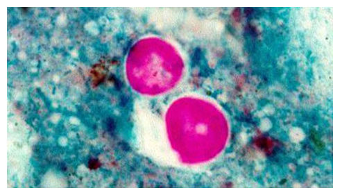 Cyclospora