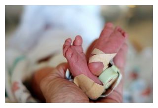 Infant