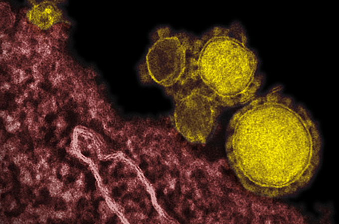 Click to enlarge MERS Coronavirus