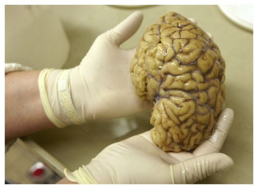 Brain