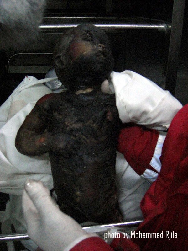 gaza chemical attack