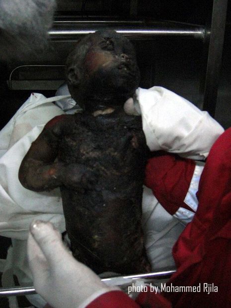 gaza chemical attack